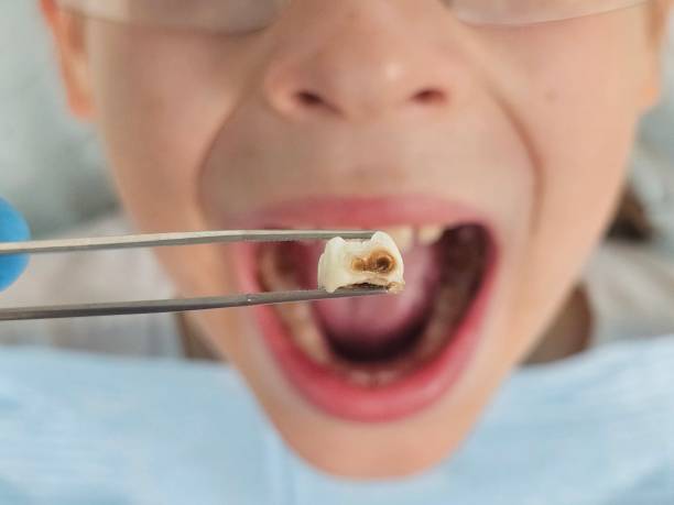 Best Emergency Orthodontic Repairs in Eaton, IN